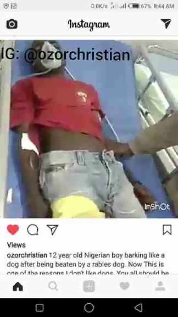 TOO BAD!! This 12-Year-Old Boy, Barks Like A Dog After A Dog Bite (Pics, Video)